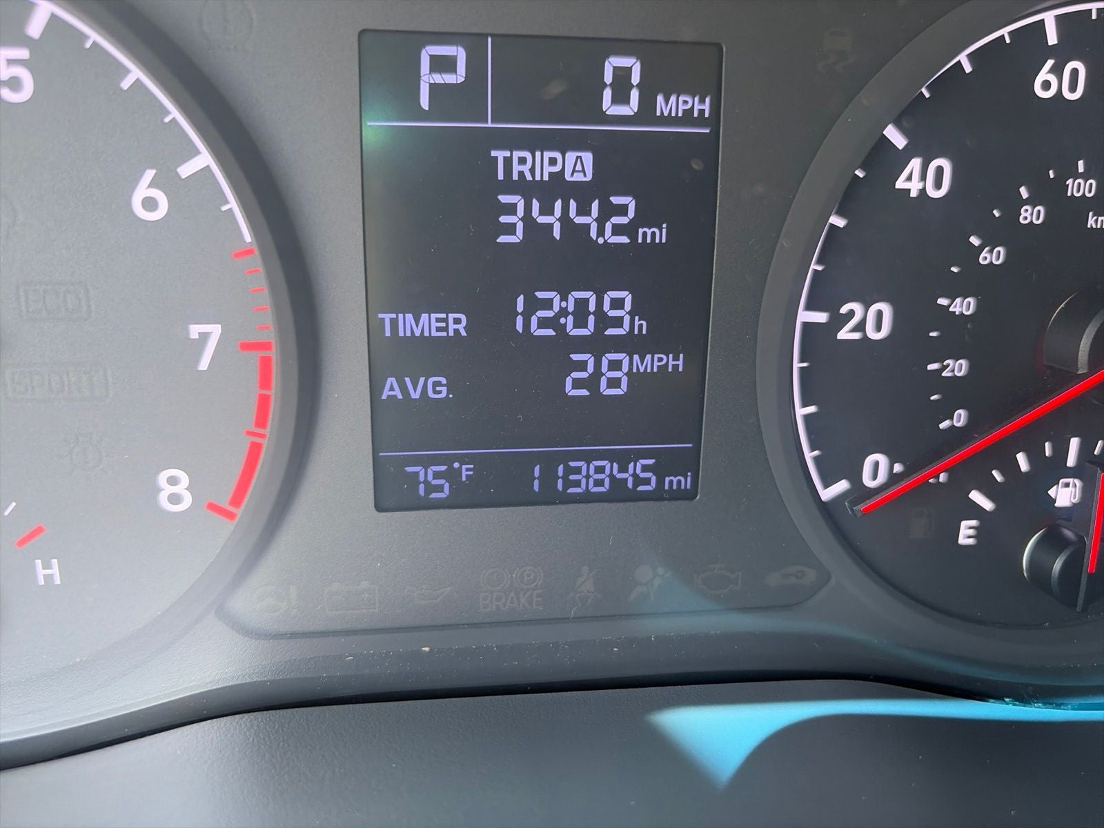 2018 Hyundai Accent SE